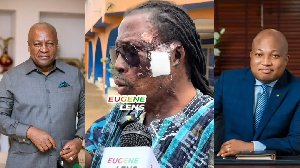 ‘I need a skin graft’ – Kwaku Bonsam begs Mahama, Ablakwa to facilitate US travel